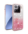Coque Xiaomi 15 Pro Fleurs et Paillettes