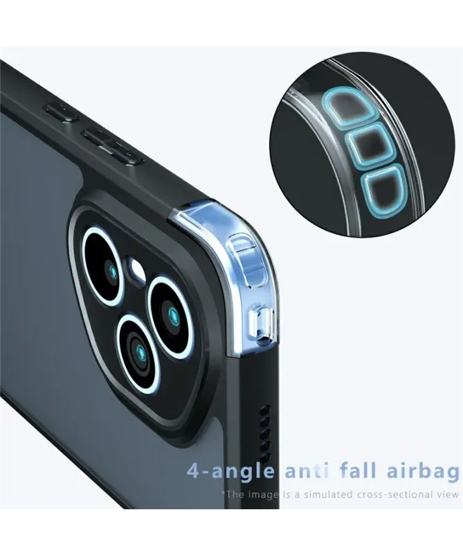 Coque Honor 400 Pro Mate