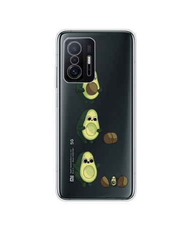 Coque Xiaomi 11T / 11T Pro illustration avocat