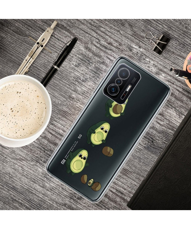 Coque Xiaomi 11T / 11T Pro illustration avocat