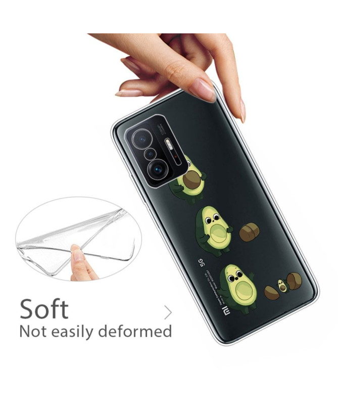 Coque Xiaomi 11T / 11T Pro illustration avocat