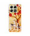 Coque Xiaomi 14T Cerf sika